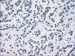 MAP2K2 Antibody in Immunohistochemistry (Paraffin) (IHC (P))