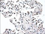 MAP2K2 Antibody in Immunohistochemistry (Paraffin) (IHC (P))