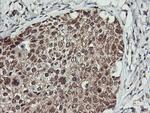 MAP2K2 Antibody in Immunohistochemistry (Paraffin) (IHC (P))