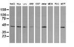 MAP2K2 Antibody in Western Blot (WB)