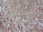 MAP2K3 Antibody in Immunohistochemistry (Paraffin) (IHC (P))