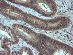 MAP2K3 Antibody in Immunohistochemistry (Paraffin) (IHC (P))