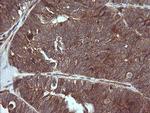 MAP2K3 Antibody in Immunohistochemistry (Paraffin) (IHC (P))