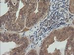 MAP2K3 Antibody in Immunohistochemistry (Paraffin) (IHC (P))