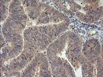 MAP2K3 Antibody in Immunohistochemistry (Paraffin) (IHC (P))