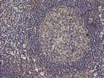 MAP2K3 Antibody in Immunohistochemistry (Paraffin) (IHC (P))