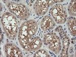 MAP2K3 Antibody in Immunohistochemistry (Paraffin) (IHC (P))