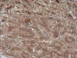 MAP2K3 Antibody in Immunohistochemistry (Paraffin) (IHC (P))