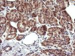 MAP2K3 Antibody in Immunohistochemistry (Paraffin) (IHC (P))