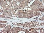 MAP2K3 Antibody in Immunohistochemistry (Paraffin) (IHC (P))