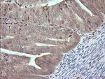 MAP2K3 Antibody in Immunohistochemistry (Paraffin) (IHC (P))