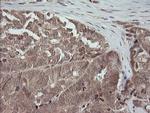 MAP2K3 Antibody in Immunohistochemistry (Paraffin) (IHC (P))