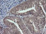 MAP2K3 Antibody in Immunohistochemistry (Paraffin) (IHC (P))