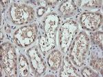 MAP2K3 Antibody in Immunohistochemistry (Paraffin) (IHC (P))