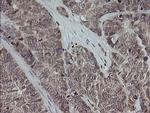 MAP2K3 Antibody in Immunohistochemistry (Paraffin) (IHC (P))