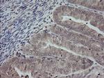 MAP2K3 Antibody in Immunohistochemistry (Paraffin) (IHC (P))