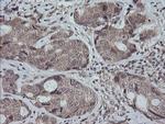 MAP2K3 Antibody in Immunohistochemistry (Paraffin) (IHC (P))