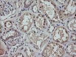 MAP2K3 Antibody in Immunohistochemistry (Paraffin) (IHC (P))