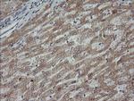 MAP2K3 Antibody in Immunohistochemistry (Paraffin) (IHC (P))