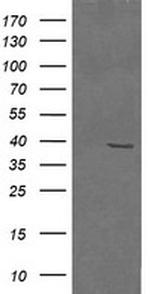 MAP2K3 Antibody in Western Blot (WB)