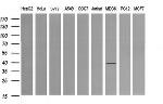 MAP2K3 Antibody in Western Blot (WB)