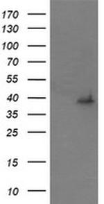 MAP2K3 Antibody in Western Blot (WB)