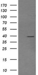 MAP2K3 Antibody in Western Blot (WB)