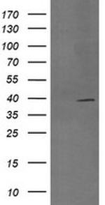 MAP2K3 Antibody in Western Blot (WB)