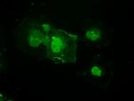 MAP2K4 Antibody in Immunocytochemistry (ICC/IF)