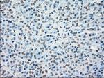 MAP2K4 Antibody in Immunohistochemistry (Paraffin) (IHC (P))