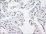 MAP2K4 Antibody in Immunohistochemistry (Paraffin) (IHC (P))