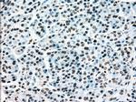 MAP2K4 Antibody in Immunohistochemistry (Paraffin) (IHC (P))