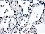 MAP2K4 Antibody in Immunohistochemistry (Paraffin) (IHC (P))