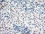 MAP2K4 Antibody in Immunohistochemistry (Paraffin) (IHC (P))