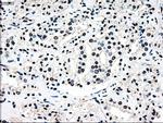 MAP2K4 Antibody in Immunohistochemistry (Paraffin) (IHC (P))