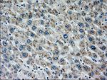 MAP2K4 Antibody in Immunohistochemistry (Paraffin) (IHC (P))