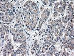 MAP2K4 Antibody in Immunohistochemistry (Paraffin) (IHC (P))