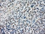 MAP2K4 Antibody in Immunohistochemistry (Paraffin) (IHC (P))