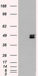 MAP2K4 Antibody in Western Blot (WB)