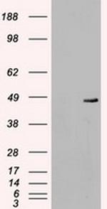 MAP2K4 Antibody in Western Blot (WB)