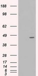 MAP2K4 Antibody in Western Blot (WB)