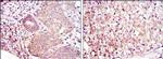 MEK6 Antibody in Immunohistochemistry (Paraffin) (IHC (P))