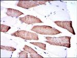 MEK7 Antibody in Immunohistochemistry (Paraffin) (IHC (P))