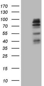 MAP3K15 Antibody in Western Blot (WB)