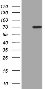 MAP3K7 Antibody in Western Blot (WB)