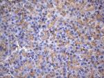 MAP3K8 Antibody in Immunohistochemistry (Paraffin) (IHC (P))