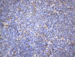 MAP3K8 Antibody in Immunohistochemistry (Paraffin) (IHC (P))