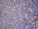 MAP3K8 Antibody in Immunohistochemistry (Paraffin) (IHC (P))