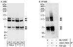 MAP7D1 Antibody in Western Blot (WB)