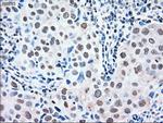 MAPK1 Antibody in Immunohistochemistry (Paraffin) (IHC (P))